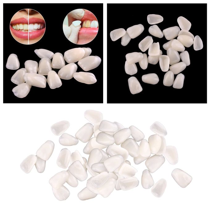 Thin Teeth Temporary Veneers Anterior Resin Mixed Beige