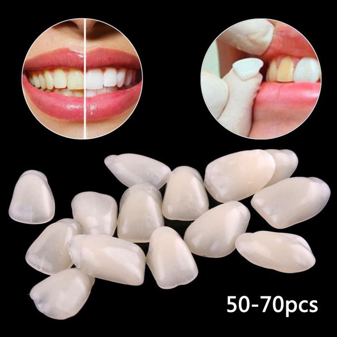 Thin Teeth Temporary Veneers Anterior Resin Mixed Beige