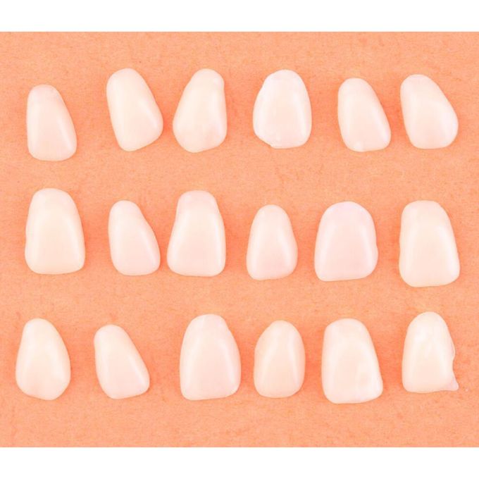 Thin Teeth Temporary Veneers Anterior Resin Mixed Beige